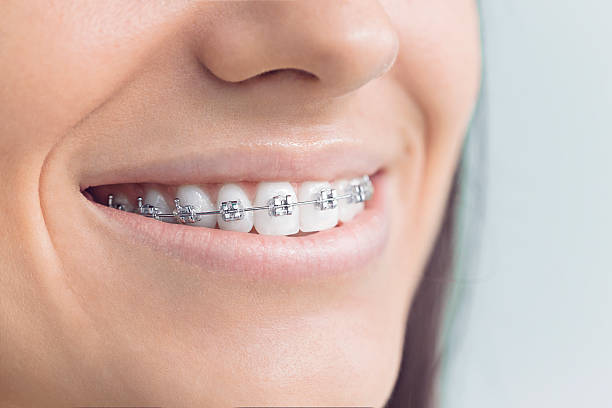 Best Dental Fillings (Composite and Amalgam)  in Beltsville, MD